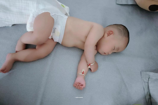 阿拉尔宝宝头上长痱子